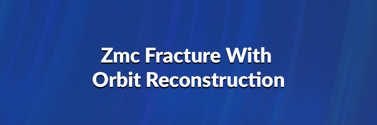 ZMC Fracture with Orbit Reconstruction